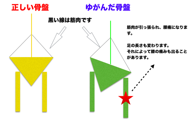 骨盤の説明